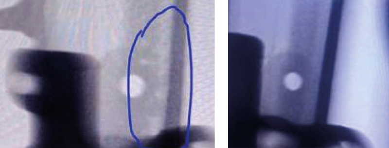 X-ray inspection of the casting before (left) and after optimization of the slide insert (right) 